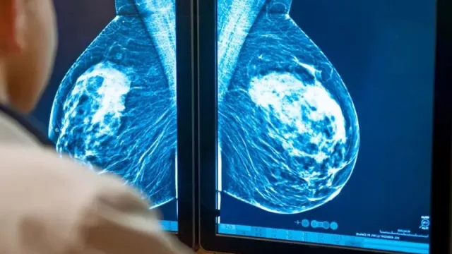 GE HealthCare y RadNet se asocian para transformar la radiología con inteligencia artificial